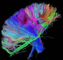 [Brain scan of white matter fibers, brainstem and above. The fibers are color coded by direction: red = left-right, green = anterior-posterior, blue = ascending-descending (RGB=XYZ). The Human Connectome Project, a $40-million endeavor funded by the National Institutes of Health, aims to plot connections within the brain that enables the complex behaviors our brains perform so seamlessly.MANDATORY CREDIT: Courtesy of the Laboratory of Neuro Imaging at UCLA and Martinos Center for Biomedical Imaging at MGH / www.humanconnectomeproject.org] *** []